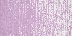 Purple 2 M